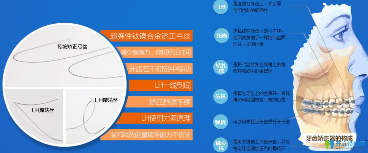 LH魔線快速矯正技術(shù)