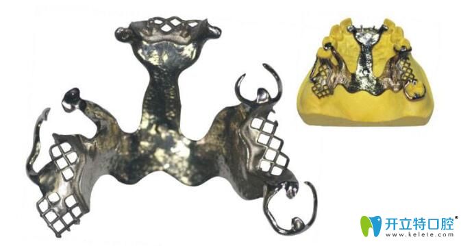 純鈦支架優(yōu)點(diǎn)