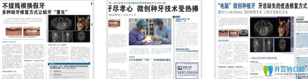 杭州美奧口腔種牙怎么樣