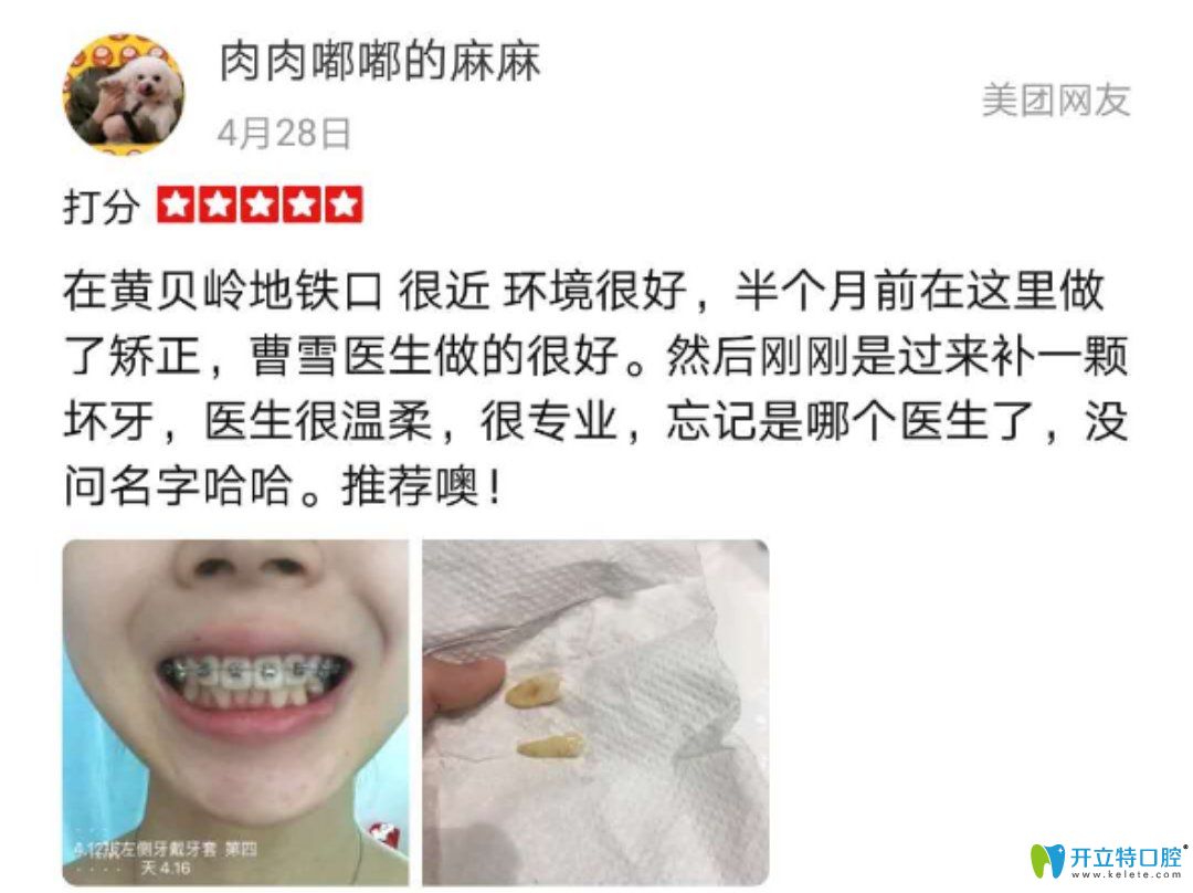 諾德齒科正畸真實反饋