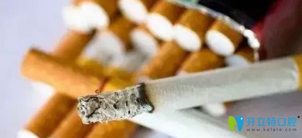 拔牙后吸煙容易誘發(fā)干槽癥