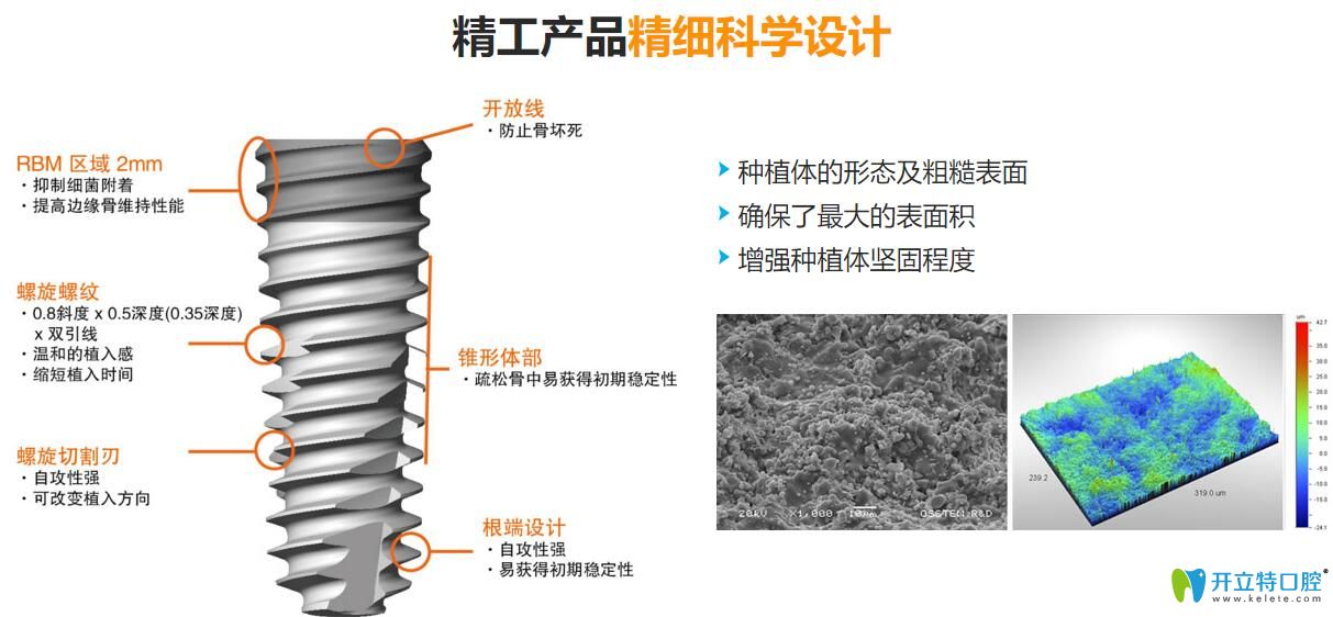 韓國(guó)種植牙質(zhì)量怎么樣？韓國(guó)種植體價(jià)格為什么比較便宜？