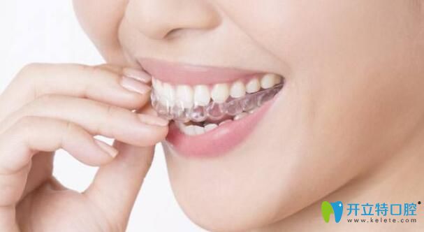 黃淘醫(yī)生科普:隱形矯正有哪些優(yōu)勢(shì) 黃淘醫(yī)生科普:隱形矯正有哪些優(yōu)勢(shì)