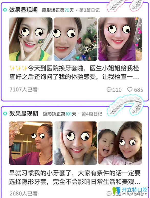 在無(wú)錫佳士潔口腔做過(guò)牙齒矯正的顧客評(píng)價(jià)