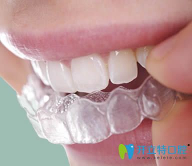 韋飛科普隱形牙齒矯正有哪些優(yōu)點(diǎn)