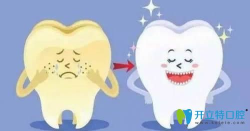 正常健康的牙齒顏色是淺黃色的