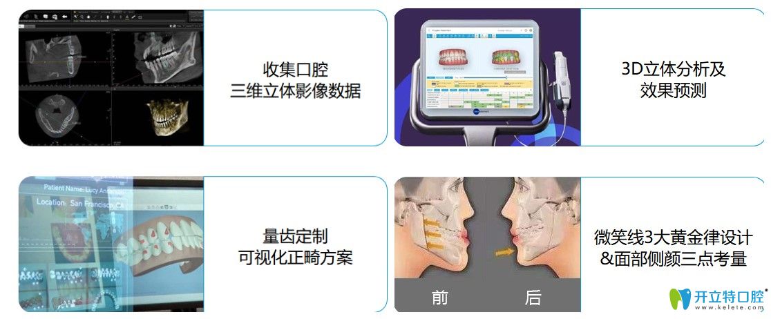 深圳弘和口腔的牙齒矯正的先進技術