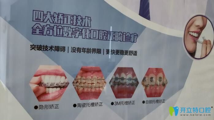 廣州圣貝口腔四大矯正技術(shù)