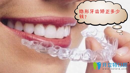 隱形矯正牙齒多少錢?時(shí)代天使價(jià)格17000元矯正效果好嗎？