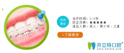 長沙利爾口腔陶瓷托槽矯正需要的時間