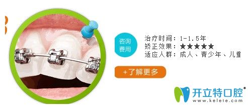 長沙利爾口腔金屬自鎖托槽矯正需要的時間