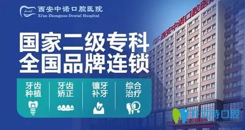 西安種植牙哪家醫(yī)院好？中諾口腔立得用種植牙可靠效果好