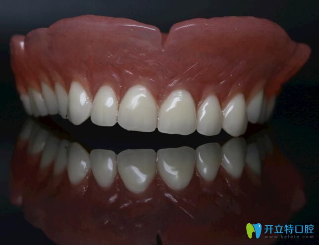 昆明尚愛(ài)韓美口腔孫亞杰介紹全口活動(dòng)義齒的優(yōu)缺點(diǎn)