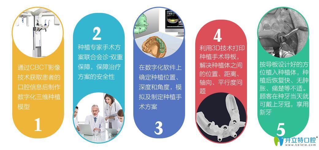 博韻口腔靶向種植技術(shù)解析
