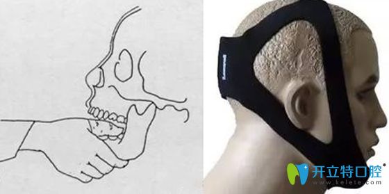 顳頜關(guān)節(jié)復位后要注意后續(xù)治療