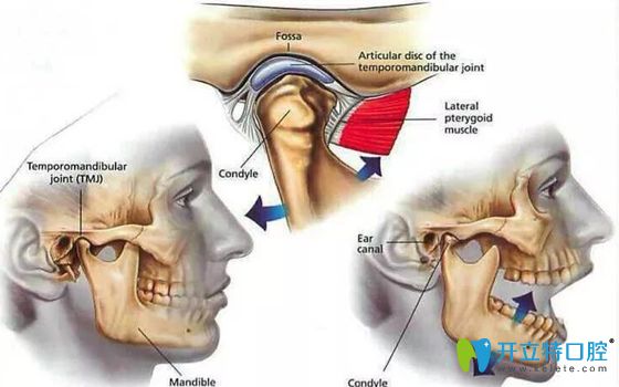 復發(fā)性顳頜關(guān)節(jié)脫位需注射治療