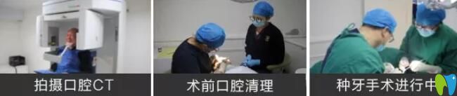 高齡老人種牙前檢查 高齡老人種牙前檢查