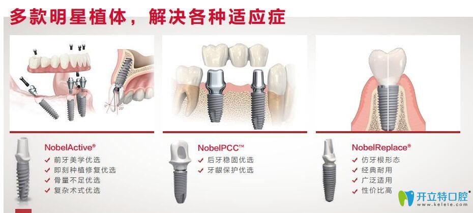 瑞典諾貝爾種植體分哪些型號(hào)?nobel cc和active的區(qū)別是什么?