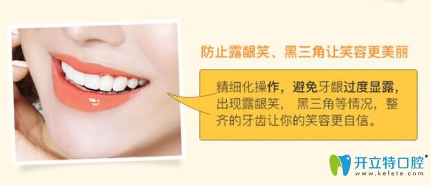 防止牙齒矯正過程中的露齦笑、黑三角