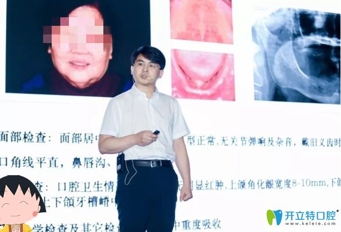 維樂口腔時(shí)紹忠院長分享全口無牙頜種植案例圖示