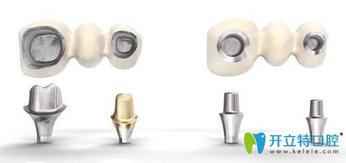 種植牙純鈦基臺(tái)