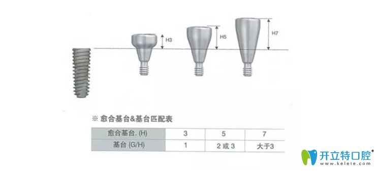 種植牙愈合基臺也是分大小的