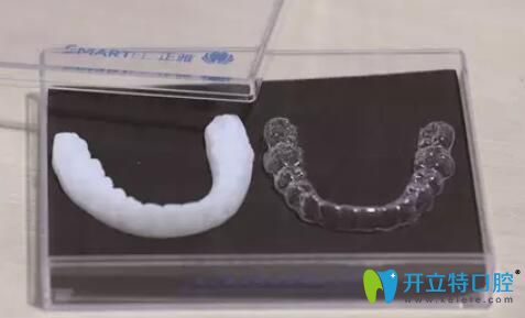 正雅隱形牙套