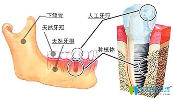 牙齒在牙頜骨中的構(gòu)造圖