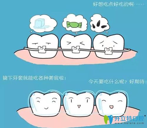 隱形矯正牙套更方便、舒適