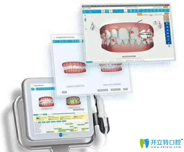 福州中澤口腔牙齒矯正口掃儀