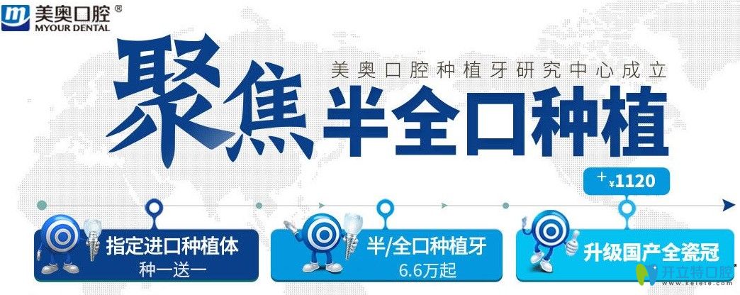 超劃算！杭州美奧口腔美國皓圣和法國安卓健都是種1送1吶