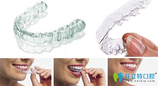 陶泉欣醫(yī)生對(duì)隱形正畸有著深入的研究