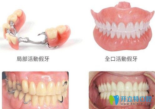 汪醫(yī)生指出大家只要弄清楚這三種修復(fù)方式的優(yōu)缺點之后就知道該如何選擇