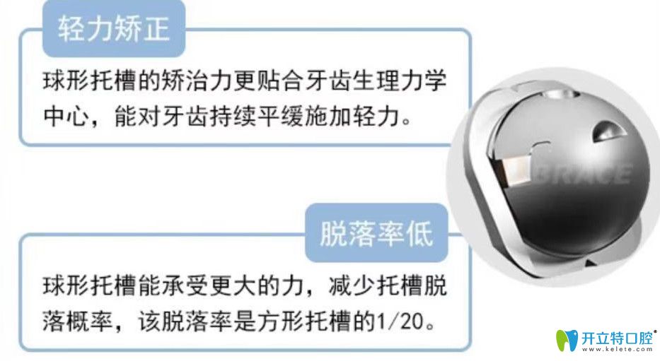 球面自鎖托槽矯正器優(yōu)勢(shì)