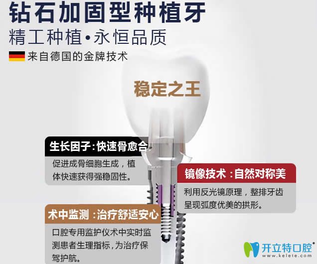 廣州圣貝口腔鉆石加固型種植牙技術(shù)