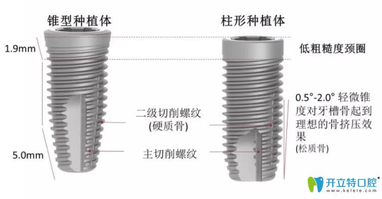 瑞典尼奧斯種植體型號(hào)