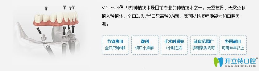 All-on-4即刻種植牙的簡介及優(yōu)勢圖