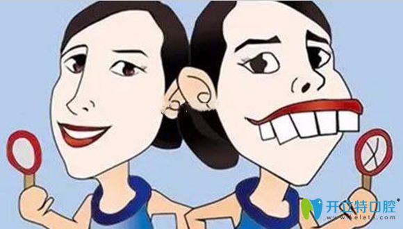 齙牙做牙齒矯形的前后效果對比