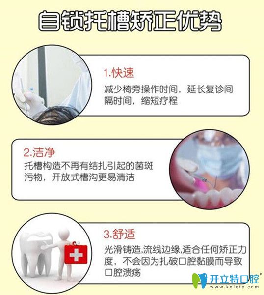 自鎖托槽矯正的優(yōu)勢