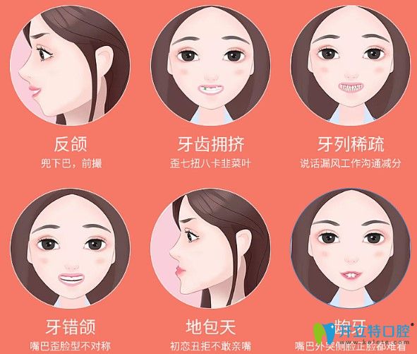 隱形矯正能矯正各種牙齒畸形