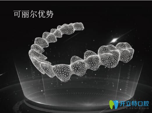 可麗爾牙套