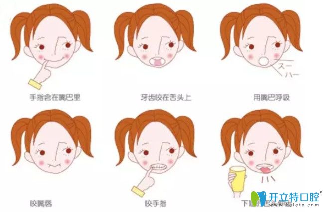 咬合誘導(dǎo)技術(shù)都有哪些？?jī)和Ш险T導(dǎo)有啥副作用？