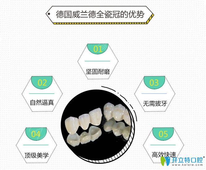 德國威蘭德全瓷牙優(yōu)點