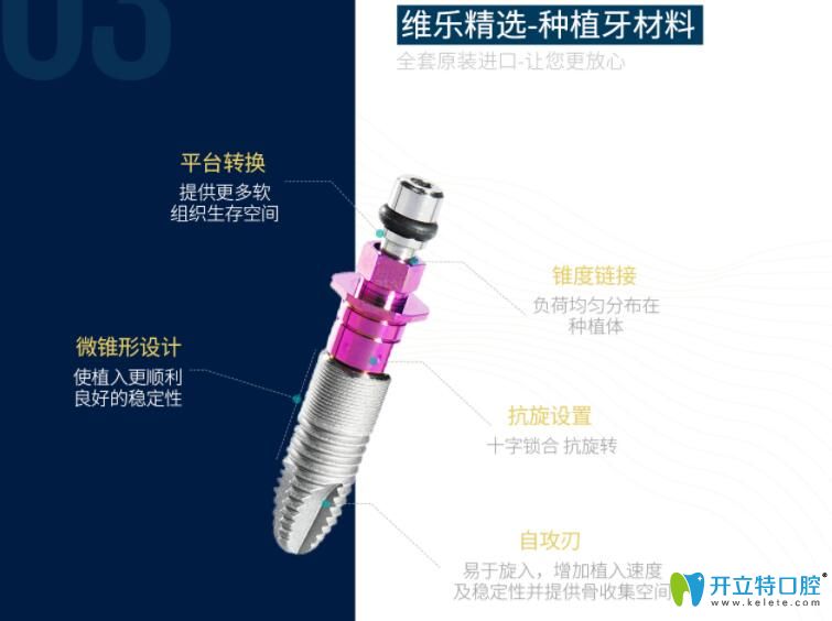 福州維樂(lè)口腔種植牙材料安全