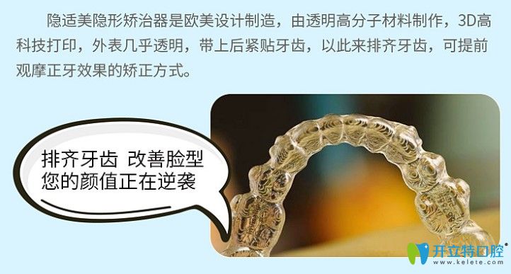 隱形牙套的優(yōu)勢(shì)