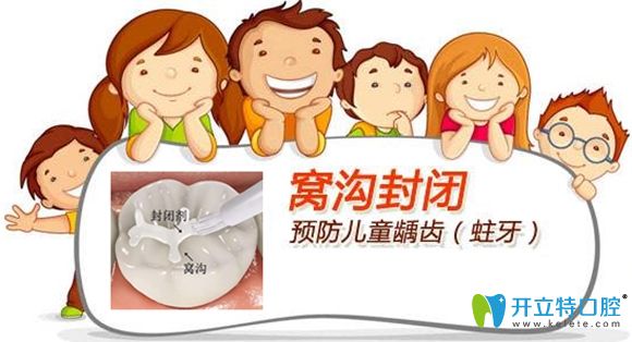 圣貝口腔窩溝封閉可預防兒童齲齒