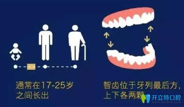 拔智齒