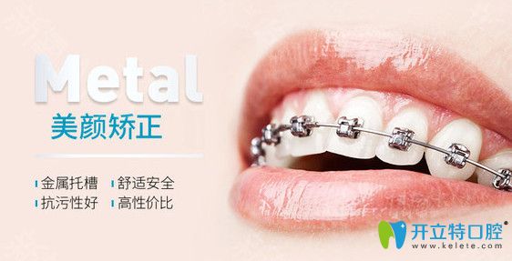 <i data-id=23833288-14a5-4eb2-926e-abdbdbdfd4ee></i>口腔Prussian美顏正畸技術