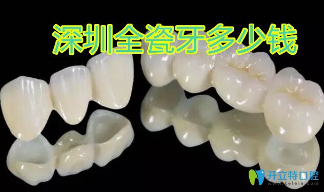 深圳全瓷牙價格