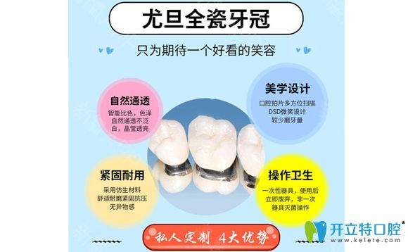 <!--<i data=20240703-sp></i>-->尤旦口腔全瓷牙優(yōu)勢(shì)介紹圖